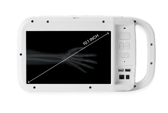 PRX Screen PRX Screen