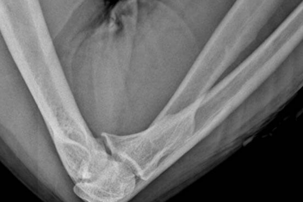 X Ray Results 1 X Ray Results 1