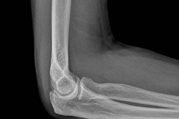 X Ray Results 2 X Ray Results 2