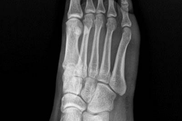 X Ray Results 3 X Ray Results 3