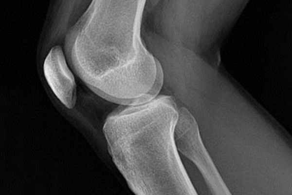 X Ray Results 4 X Ray Results 4