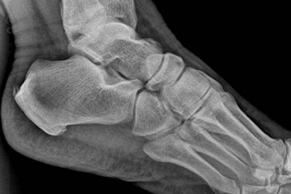 X Ray Results 5 X Ray Results 5