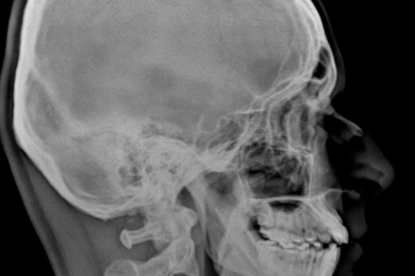 X Ray Results 7 X Ray Results 7