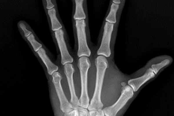 X Ray Results 8 X Ray Results 8