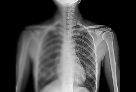 X Ray Results 9 X Ray Results 9